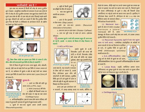 arthroscopy 2