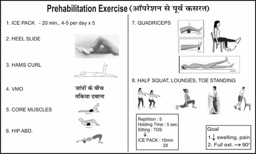 Prehabilitation