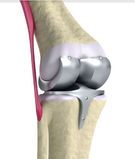 knee